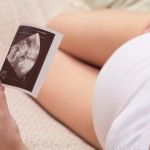 Беременность по плану